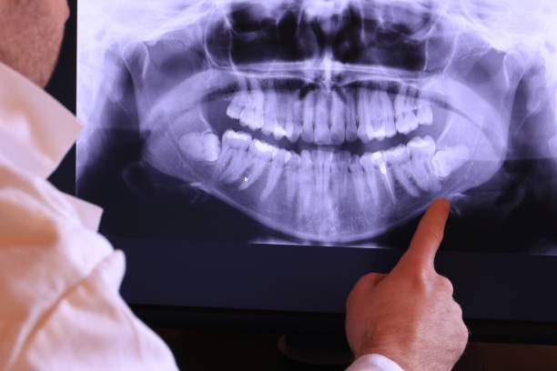 Best Emergency Dentist for Special Needs Patients in Halfway, MD